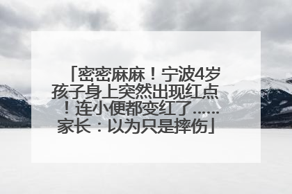 密密麻麻！宁波4岁孩子身上突然出现红点！连小便都变红了……家长：以为只是摔伤